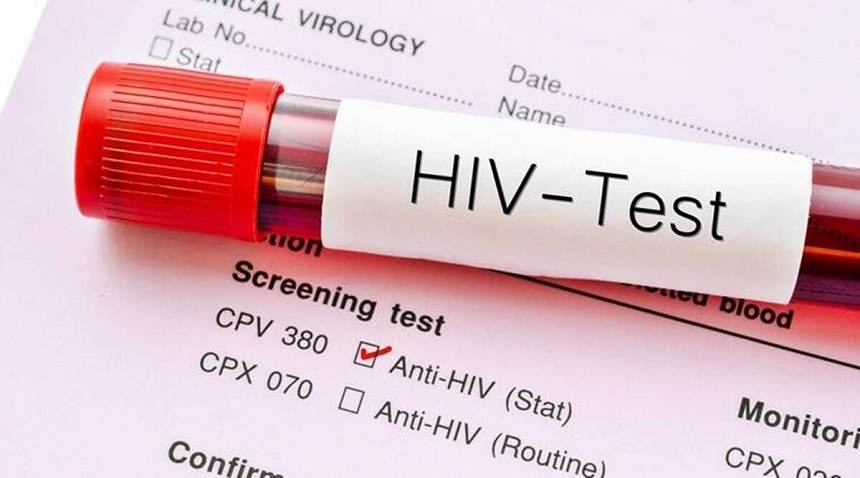 HIV Treatment Singapore: Is HIV Testing Compulsory and Required
