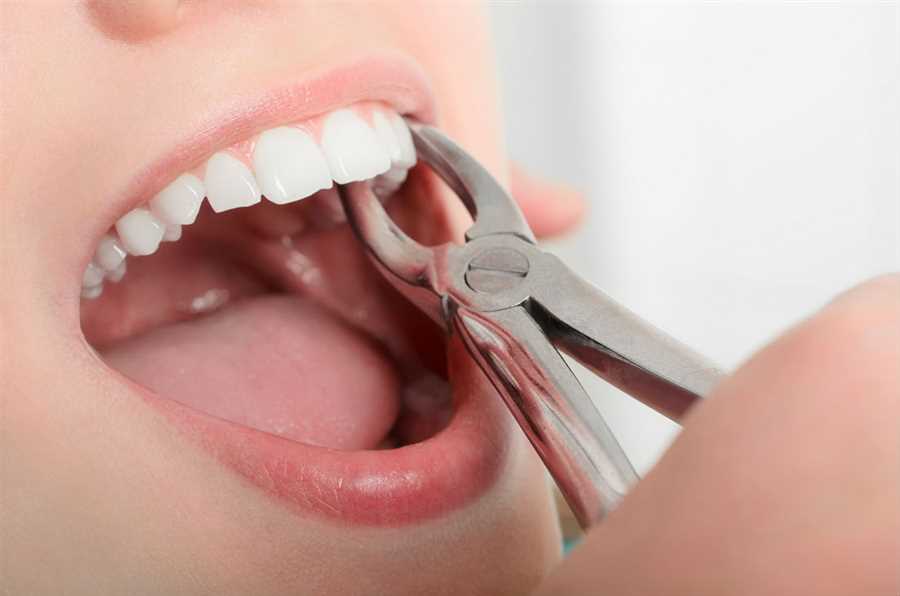 When Is the Right Time to Say That You Need a Tooth Extraction?