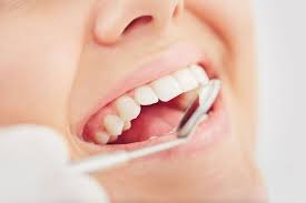 Reasons to Get Dental Implants