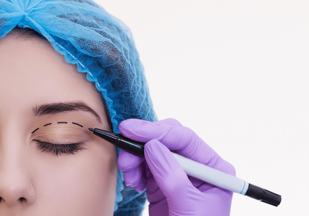 How To Find a Star Oculofacial Plastic Surgeon