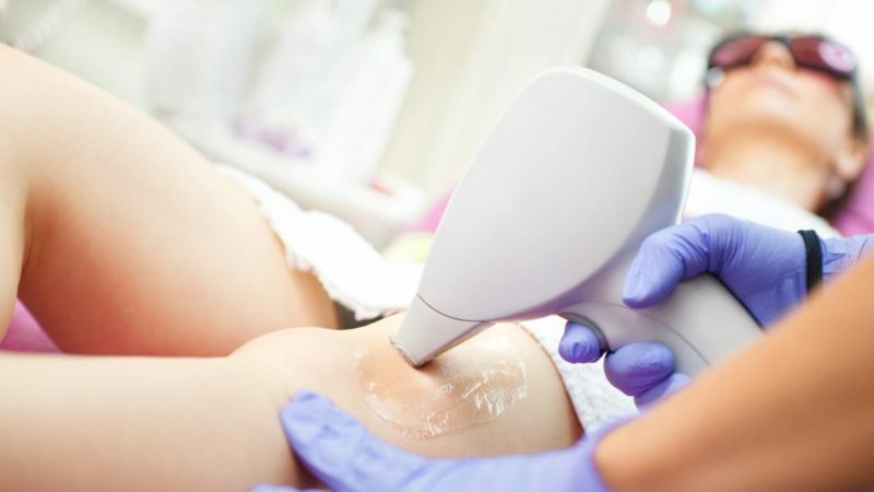 Important Details to Understand Concerning a Laser Hair Removal Procedure