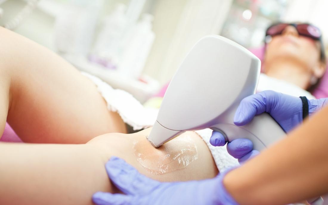 Important Details to Understand Concerning a Laser Hair Removal Procedure