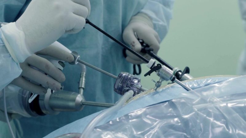 5 Key Benefits Of Minimally Invasive Surgery