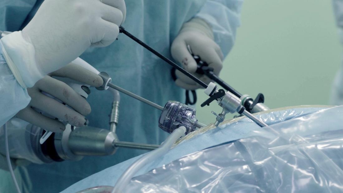 5 Key Benefits Of Minimally Invasive Surgery