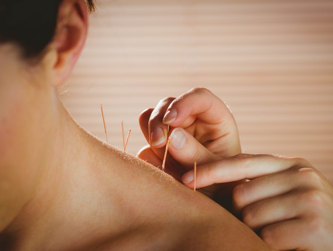 Acupuncture: An Effective Treatment For Chronic Pain