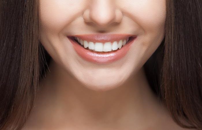 Key Dental issues Solved by Veneers