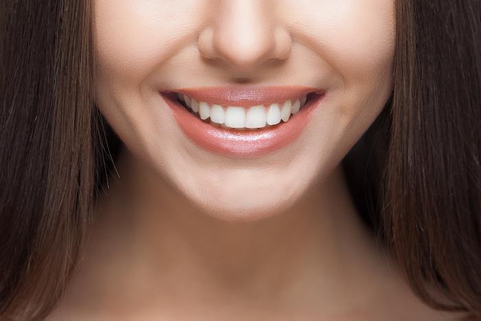 Key Dental issues Solved by Veneers